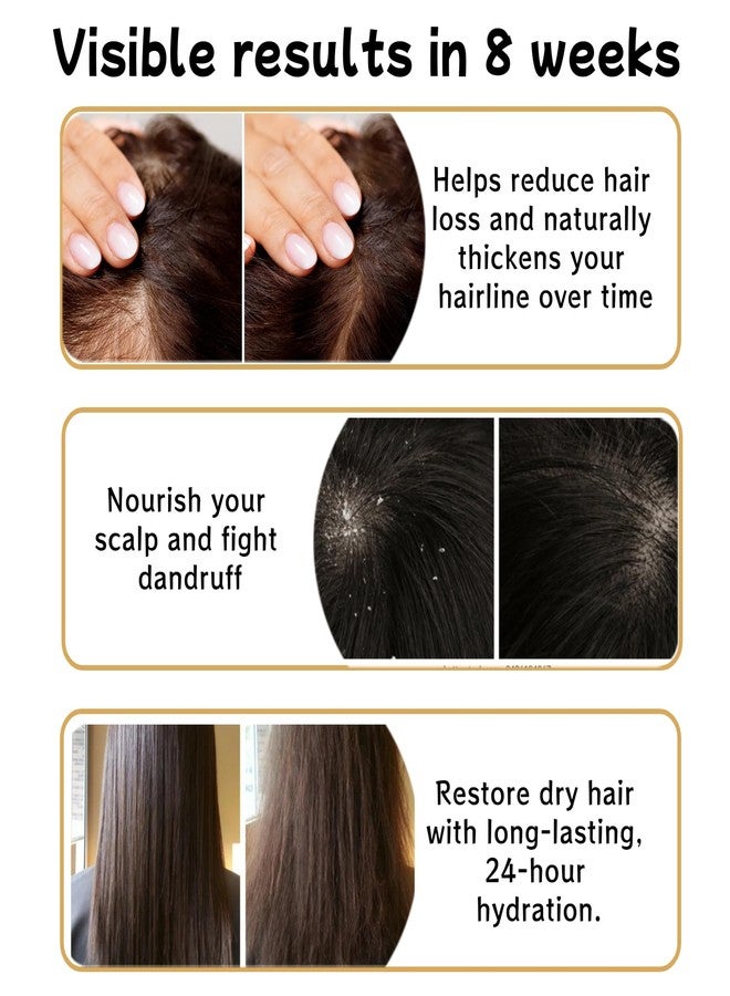 FLEXQW 2 PCS Anti Hair Loss Shampoo, Promote Hair Growth and Thickening & Strengthening Shampoo with Various Plant Extracts for Thinning Hair Women（300ml） - Image 2